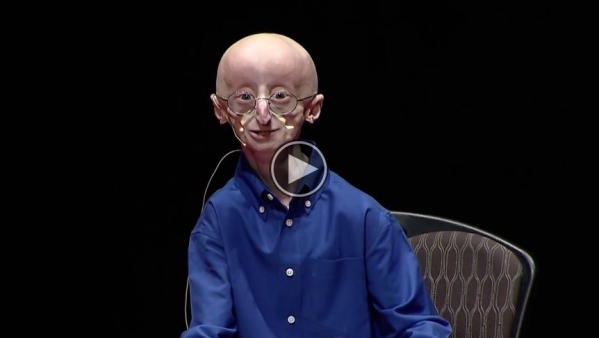 This 17-Year-Old Revealed His 3 Secrets To Happiness,Right Before Dying From A Rare Disease.