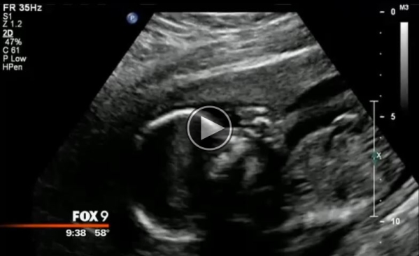 This Mother Sold Her Stillborn Baby’s Crib At A Garage Sale. What A Stranger Did Next Is Amazing